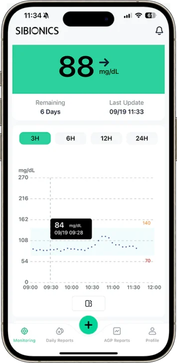 SIBIONICS App home screen